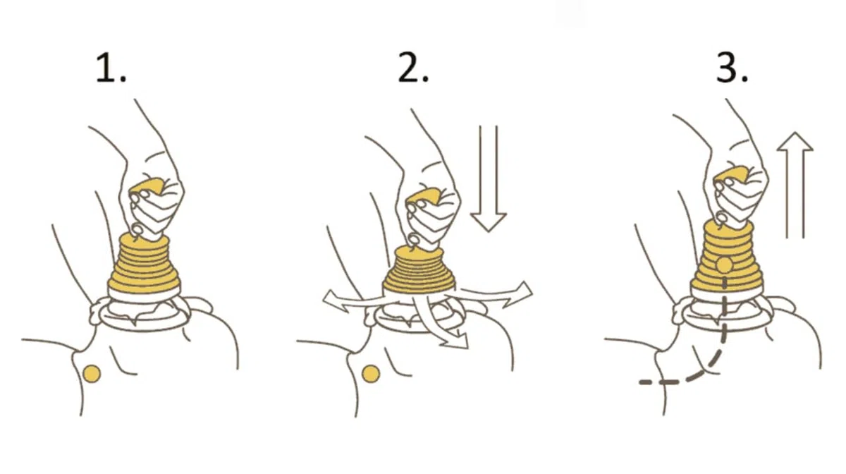 LifeVac Duo Pack 2 Kits Complets Anti-Étouffement Adultes Enfants avec 4 Masques et Sac de Transport