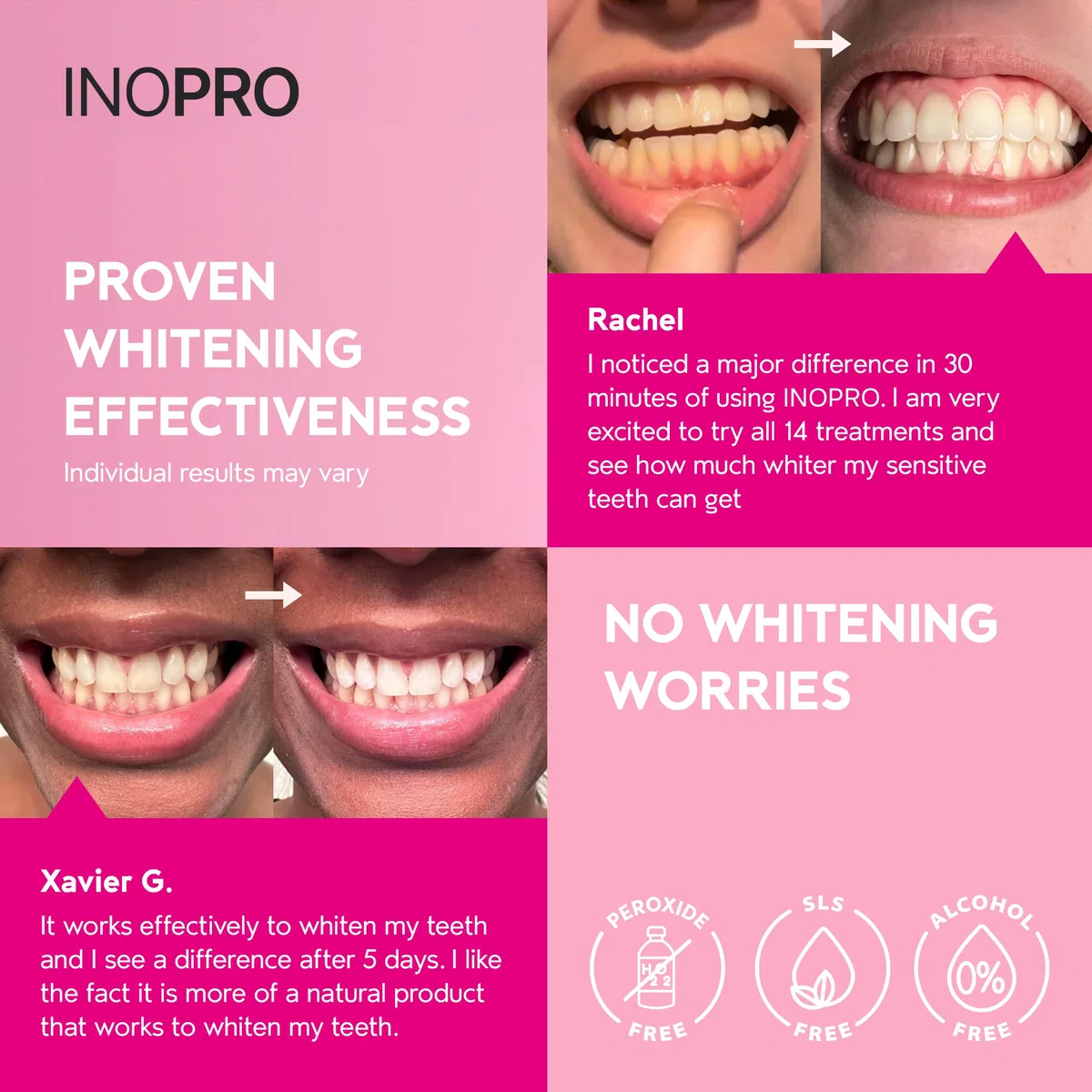 InoPro Green Teeth Whitening Strips - Peroxide Free - Deep Stains Removal - 14 Treatments, 28 Strips